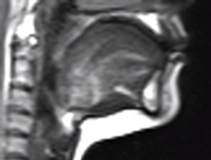 an fMRI image of Lauren's articulators in resting position